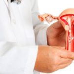 La importancia de la detección temprana para prevenir el cáncer de cuello uterino