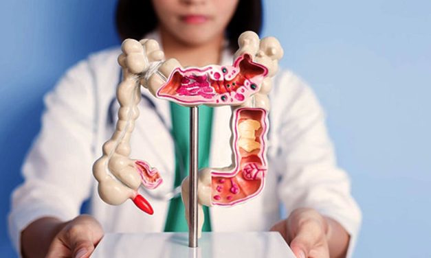 Instalan un colon gigante en el Parque Las Heras para concientizar sobre el cáncer colorrectal