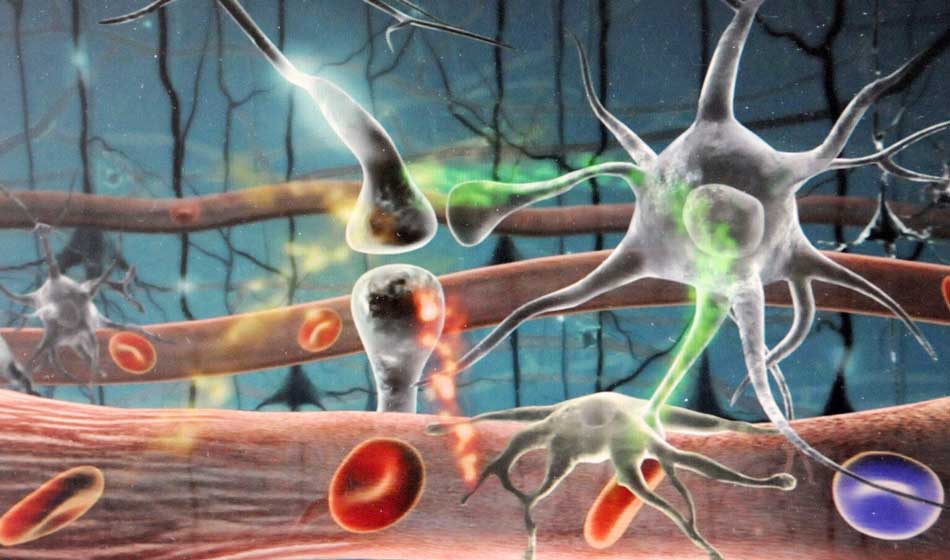 neuronas 