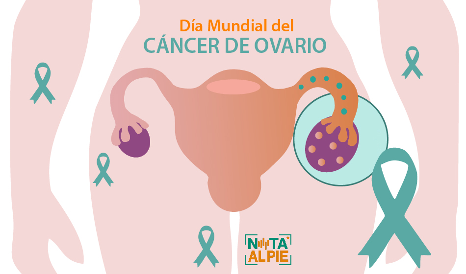 cáncer de ovario