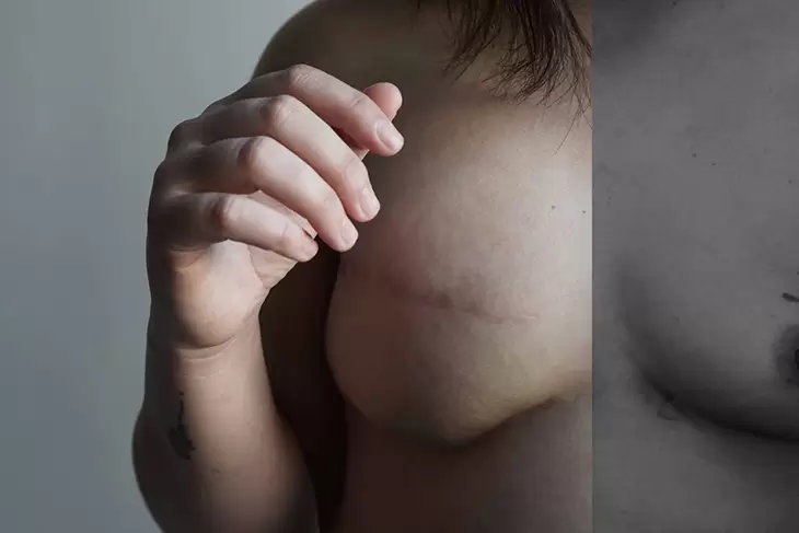 Retratos que hablan: un concurso fotográfico sobre pacientes oncológicos 3 Maria Eugenia Herrero